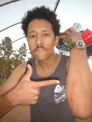 Griffin suffered severe injuries making the greatest catch in all of Sloshball